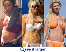 Celebrity liposuction