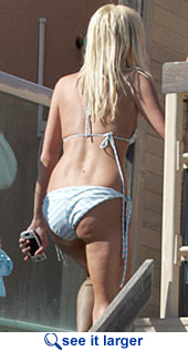 Paris Hilton cellulite