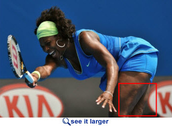 Serena Williams cellulite