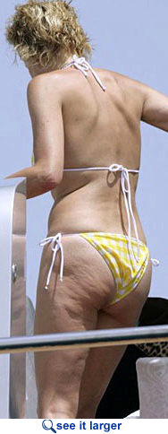 Sharon Stone cellulite