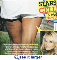Pamela Anderson Cellulite